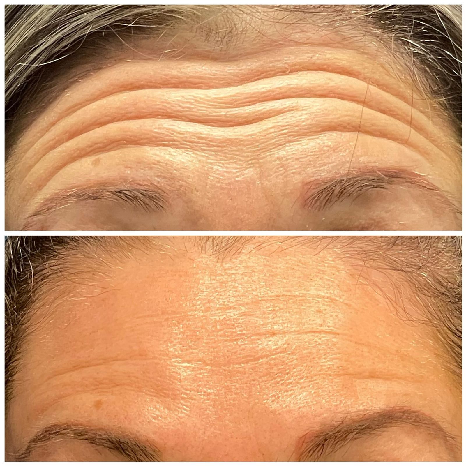 Medicina estética
